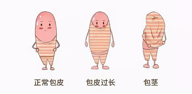 儿童包皮一定要切吗,半岛网页版