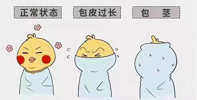 齐齐哈尔包皮包茎半岛网页版